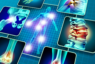 Webinar: CRPS